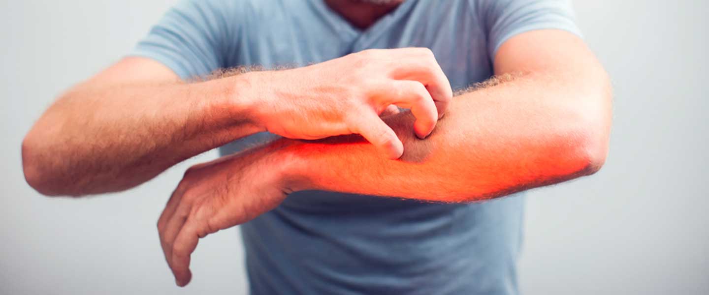 Kaşıntının sebepleri