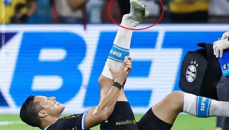 Süper Lig’in Eski Yıldızı Ayağını Kırdı: Futbol Camiası Şokta!