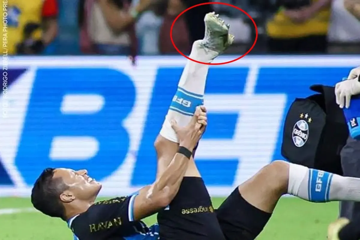 Süper Lig’in Eski Yıldızı Ayağını Kırdı: Futbol Camiası Şokta!