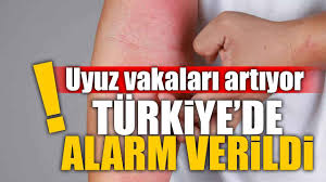 Uyuz Vakalarında Türkiye’de Alarm Zilleri Çalıyor! Belirtiler ve Korunma Yolları Neler?